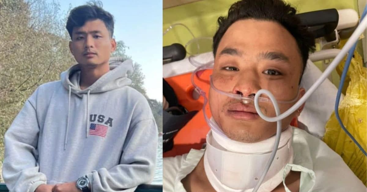 Anjel Chakma's Tragic Death Confront Racism Against Northeast Indians